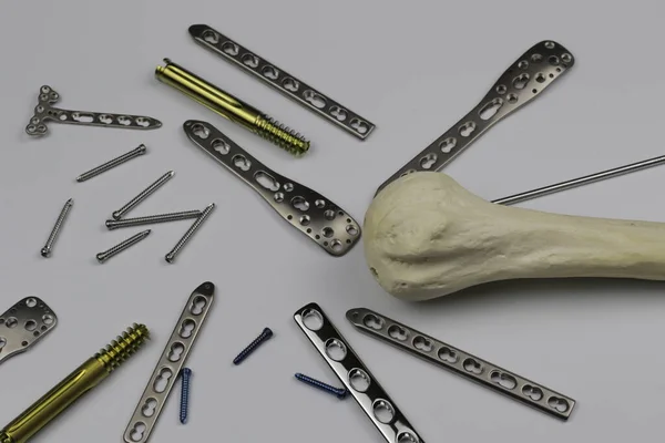 Płytka Chirurgiczna Osteosyntezy Przypadku Złamań Kości — Zdjęcie stockowe