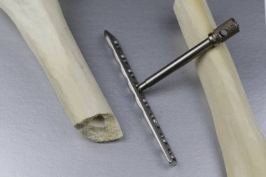 Kemik kırıklarının tedavisi için cerrahi aletler.