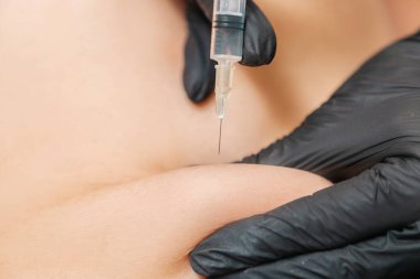 Yağ aldırma. Doktor insanın karnına lipolitik enjeksiyon yapar. Kapatın. Güzellik salonunda profesyonel kozmetoloji.