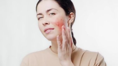 Genç ve güzel bir kadının portresi parmaklarıyla kırmızı yanağına dokunuyor. Beyaz arka plan. Rosacea konsepti.
