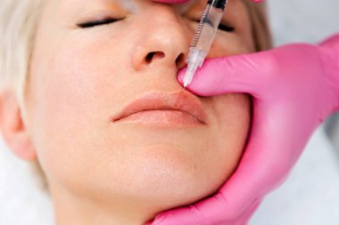 Dudak büyütme prosedürü. Güzel yetişkin bir kadının Beaty Salonu 'nda iğne olurken yakın plan portresi. Dudaklarına şırınga dolduran pembe eldivenli doktor..