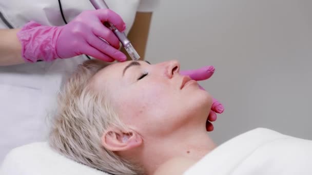 Aging Behandeling Close Portret Van Volwassen Vrouw Bij Een Mesotherapie — Stockvideo