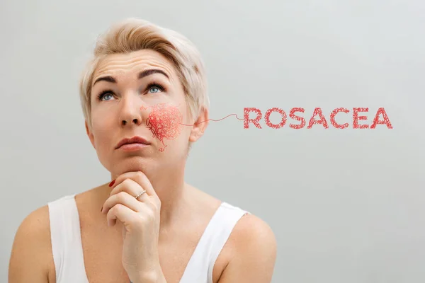 Portrait Adult Thoughtful Beautiful Woman Rosacea Her Cheek Concept Couperose — Stock Photo, Image