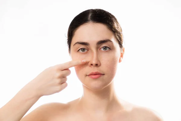 Plastic Nose Surgery Portrait Young Caucasian Woman Point Her Crooked — ストック写真