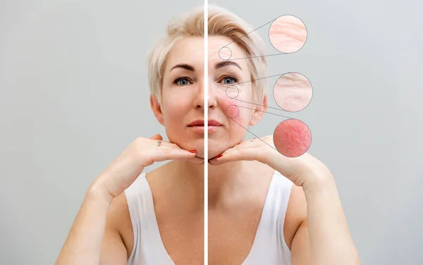 Professional Cosmetology Plastic Surgery Portrait Adult Caucasian Woman Results Rejuvenation — Stock Photo, Image
