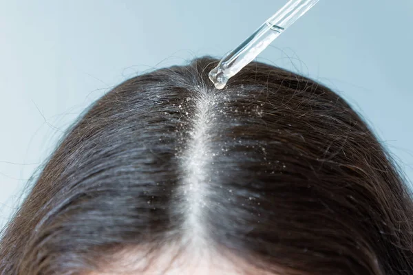 Close Female Head Dark Hair Pipette Cosmetic Product Hair Parting — Stock Photo, Image