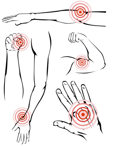 Douleurs aux bras — Image vectorielle