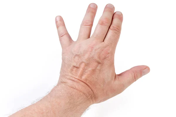 Αριστερό Χέρι Του Ενήλικου Άνδρα Απλώνεται Προς Εμπρός Μακριά Από — Φωτογραφία Αρχείου