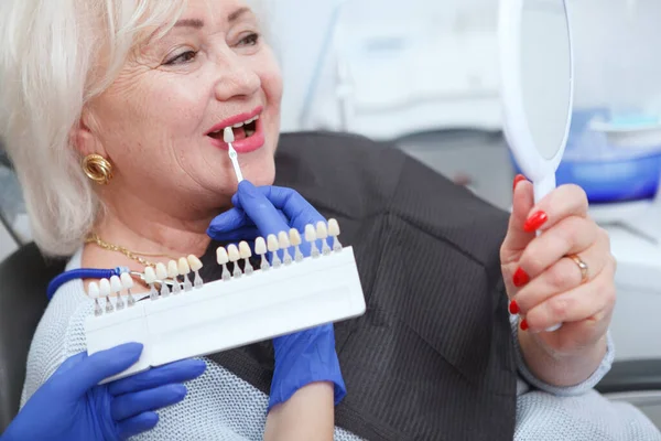 Cortado Perto Uma Mulher Sênior Escolhendo Dentes Branqueamento Sombra Clínica — Fotografia de Stock