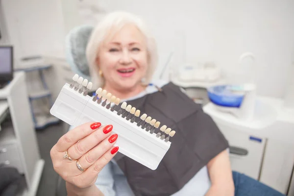 Starsza Kobieta Śmieje Się Wybiela Wykresy Odcieni Zębów Kamery Klinice — Zdjęcie stockowe