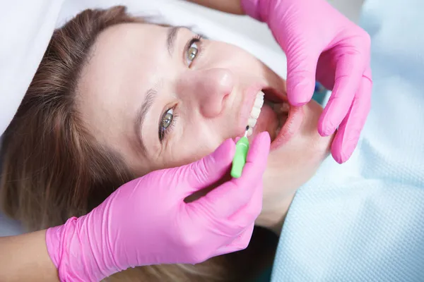 Zbliżenie Kobiety Profesjonalnie Sprzątającej Stomatologię Klinice Dentysty Używającego Szczotek Międzyzębowych — Zdjęcie stockowe