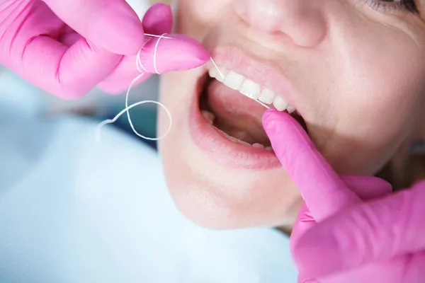 Zbliżenie Dentysty Przy Użyciu Nici Dentystycznej Czyszczenie Zębów Pacjenta — Zdjęcie stockowe