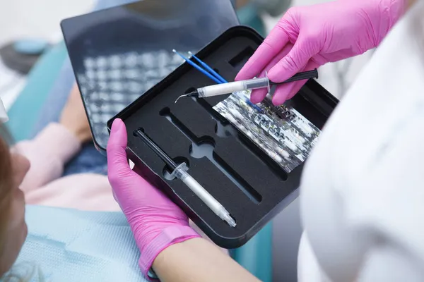 Nierozpoznawalny Dentysta Stosujący Zestaw Wybielania Zębów Klinice Stomatologicznej — Zdjęcie stockowe