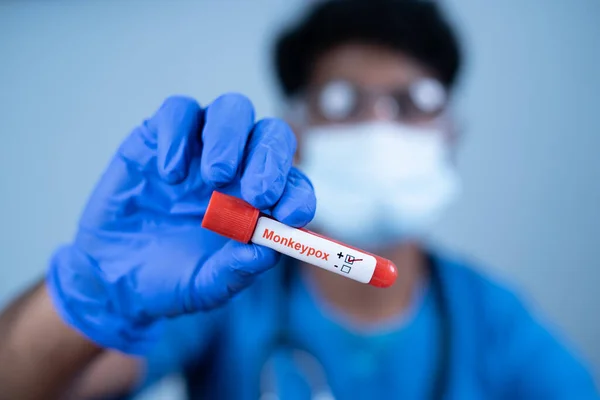 Imagine Aproape Medicului Care Prezintă Testul Pozitiv Monkeypox Probei Sânge — Fotografie, imagine de stoc