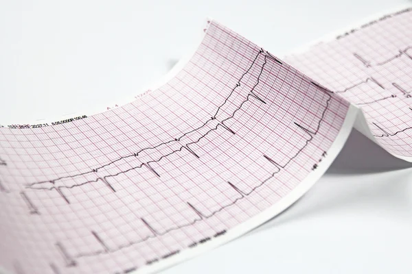 Electrocardiogram, heart EKG test — Stock Photo, Image