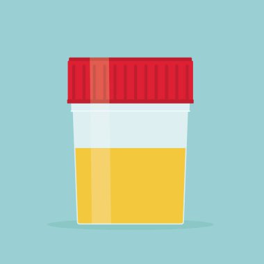 Tıbbi idrar testi - vektör illüstrasyonu