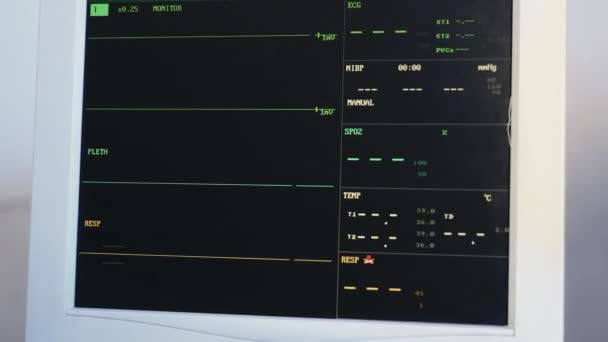 Brak Tętna Monitorze Ekg Podczas Operacji Śmierć Reanimacyjna Elektrokardiogram Szpitalnym — Wideo stockowe