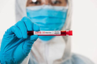 PPE üniformalı tıp bilimcileri, Coronavirus test tüpü taşıyan bir maske takıyor. Bir hastane laboratuvarında, beyaz, ilaç COVID-19 salgın konseptini analiz etmek için kullanılan bir kan örneği.