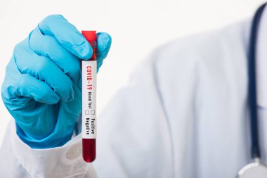 Beyaz üniformalı doktor Coronavirus test tüpü taşıyan bir maske takıyor. Klinik bir laboratuvarda, beyaz, ilaç COVID-19 salgın konseptini analiz etmek için kan örneği alınıyor.