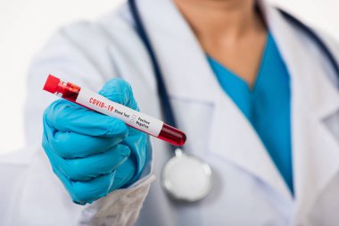 Beyaz üniformalı doktor Coronavirus test tüpü taşıyan bir maske takıyor. Klinik bir laboratuvarda, beyaz, ilaç COVID-19 salgın konseptini analiz etmek için kan örneği alınıyor.