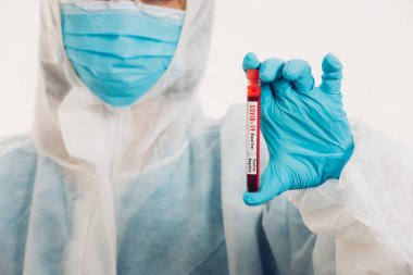 PPE üniformalı tıp bilimcileri, Coronavirus test tüpü taşıyan bir maske takıyor. Bir hastane laboratuvarında, beyaz, ilaç COVID-19 salgın konseptini analiz etmek için kullanılan bir kan örneği.