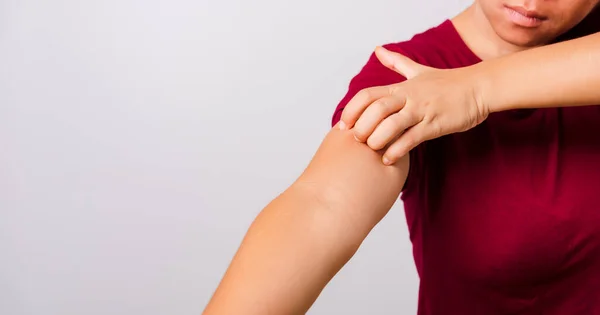 Asian Beautiful Woman Itching Her Scratching Her Itchy Arm White — Stock Photo, Image