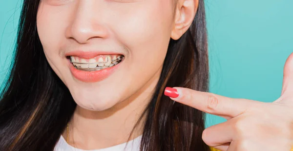 アジアの美しい若い女性ティーン指差す指に歯 幸せなタイの女性の肖像画自信を持って笑顔を示す白い歯 青の背景に隔離されたスタジオショット 歯科医療の概念 — ストック写真