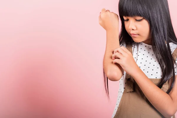 Asiatisches Kleines Kind Jahre Alt Kratzt Den Juckenden Arm Von — Stockfoto