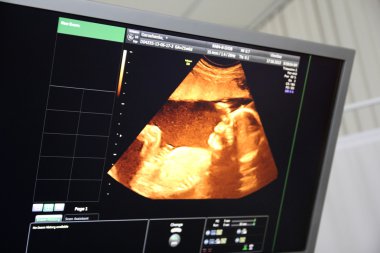 bir çocuk hamile bir karın ultrasonu ekranda