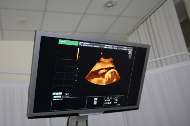 bir çocuk hamile bir karın ultrasonu ekranda