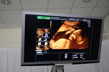 bir çocuk hamile bir karın ultrasonu ekranda