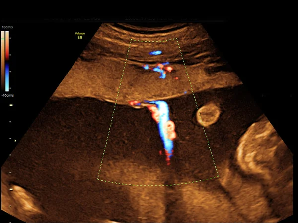 Baby on the ultrasound image — Stock Photo, Image