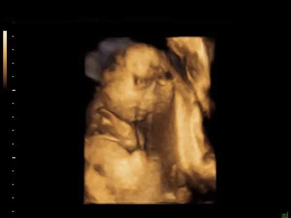 Baby on the ultrasound image — Stock Photo, Image