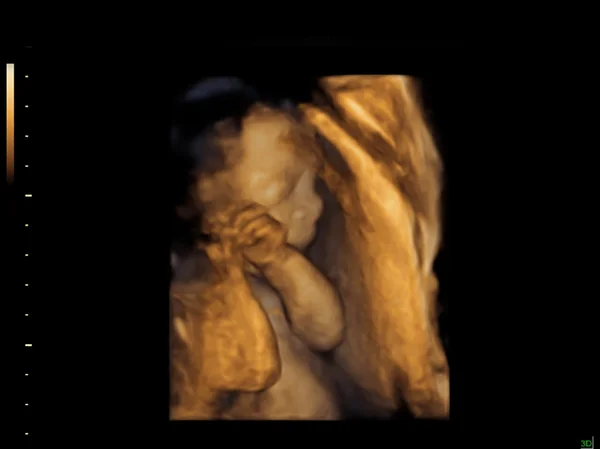 Barnet på bilden för ultraljud — Stockfoto