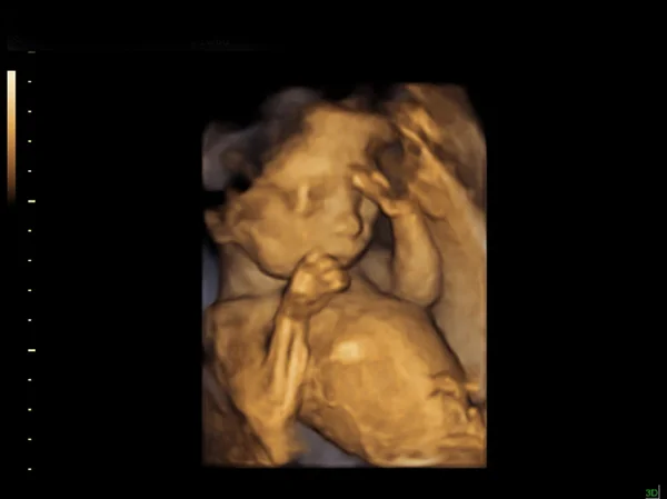 Baby auf dem Ultraschallbild — Stockfoto