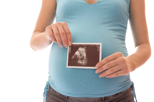 La femme enceinte sur fond blanc — Photo