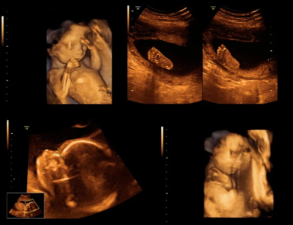 Niño en la imagen ultrasonido —  Fotos de Stock