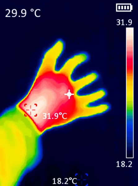 Immagine Termografica Della Mano Una Persona Che Mostra Temperature Diverse — Foto Stock