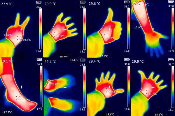 Termograficzny Obraz Dłoni Osoby Wykazującej Różne Temperatury Różnych Kolorach Niebieskiego — Zdjęcie stockowe