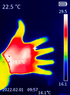 İnsan kalbi olan bir elin termografik görüntüsü, farklı renkte sıcaklıkları gösteren, soğuğu gösteren mavi 'den, ısıyı gösteren kırmızı' ya kadar, eklemlerde iltihaplanma olabilir.. 