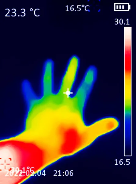 Termograficzny Obraz Dłoni Ludzkim Sercem Pokazujący Różne Temperatury Różnych Kolorach — Zdjęcie stockowe