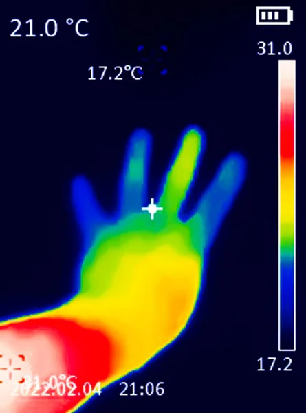 Een Thermografisch Beeld Van Een Hand Met Een Menselijk Hart — Stockfoto