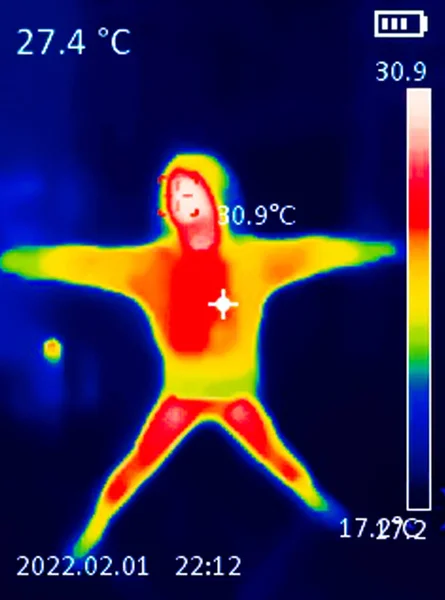 低温を示す青色から熱を示す赤色まで さまざまな色で異なる温度を示す人の体の熱画像は 関節の炎症を示す可能性があります レッドパーム — ストック写真