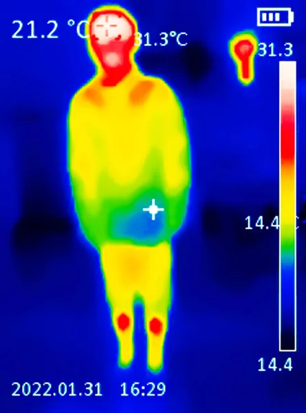 低温を示す青色から熱を示す赤色まで さまざまな色で異なる温度を示す人の体の熱画像は 関節の炎症を示す可能性があります レッドパーム — ストック写真