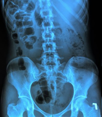 X-ray of the pelvis and spinal column clipart