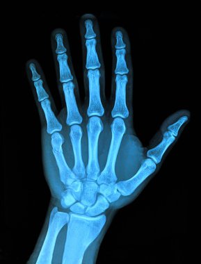 Hand x-ray clipart