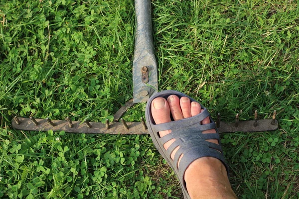 Human foot stepping on a rake