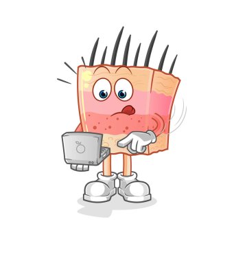 skin structure with laptop mascot. cartoon vector