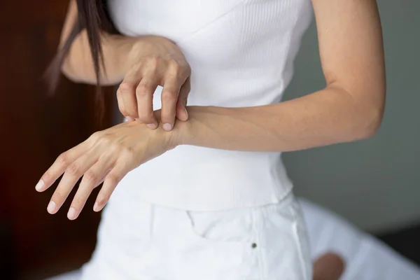 Asiatisk Kvinna Repar Sin Hand Hud Begreppet Torr Hud Allergisk — Stockfoto