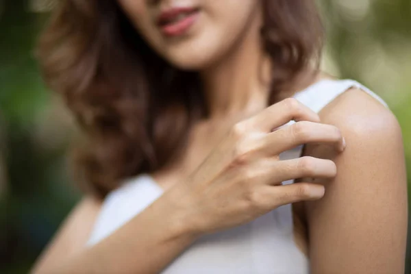 Wanita Asia Menggaruk Kulit Lengannya Konsep Kulit Kering Alergi Dermis — Stok Foto